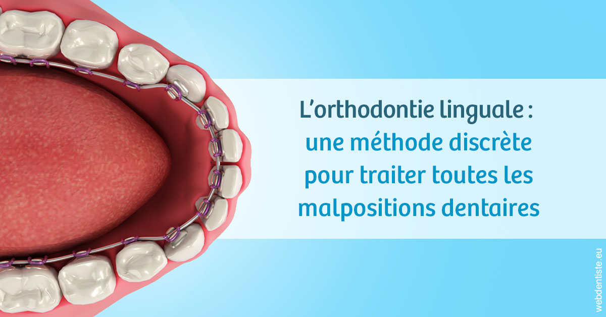 https://dentistes-trinite.com/L'orthodontie linguale 1