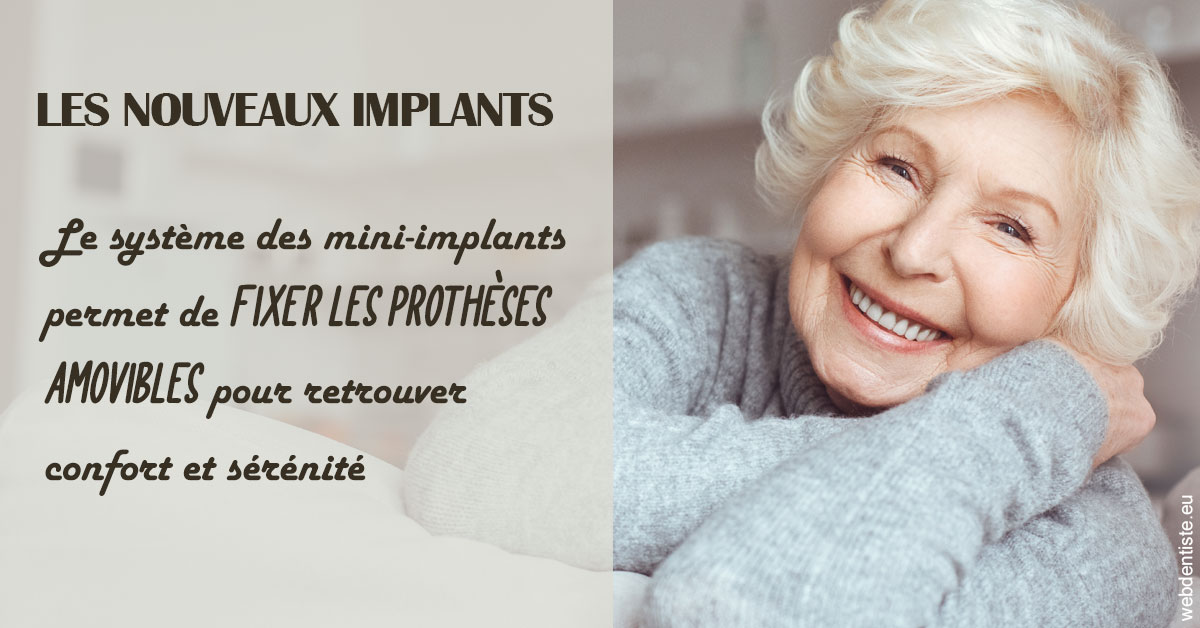 https://dentistes-trinite.com/Les nouveaux implants 1