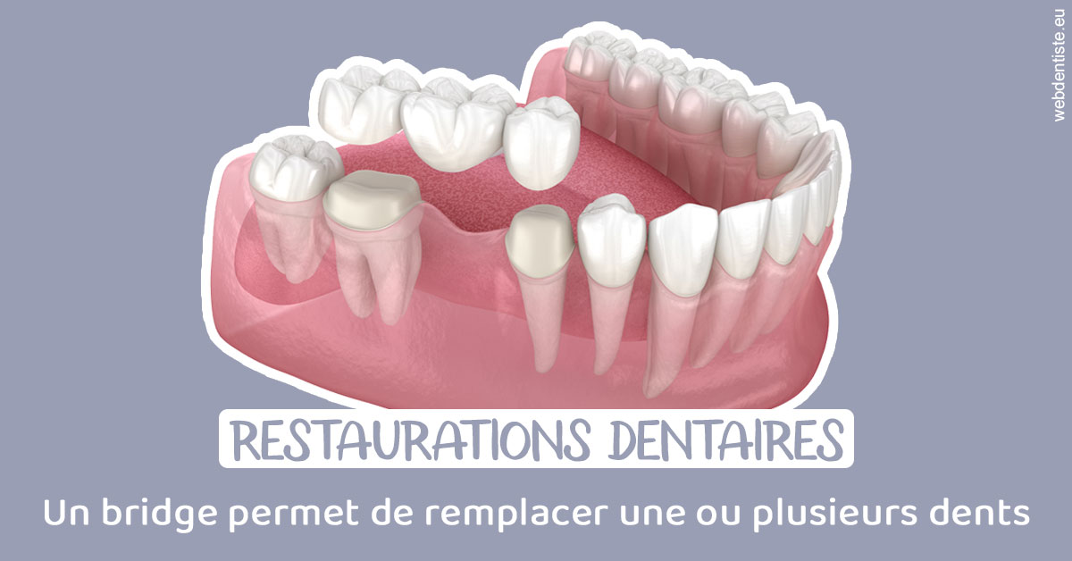 https://dentistes-trinite.com/Bridge remplacer dents 1