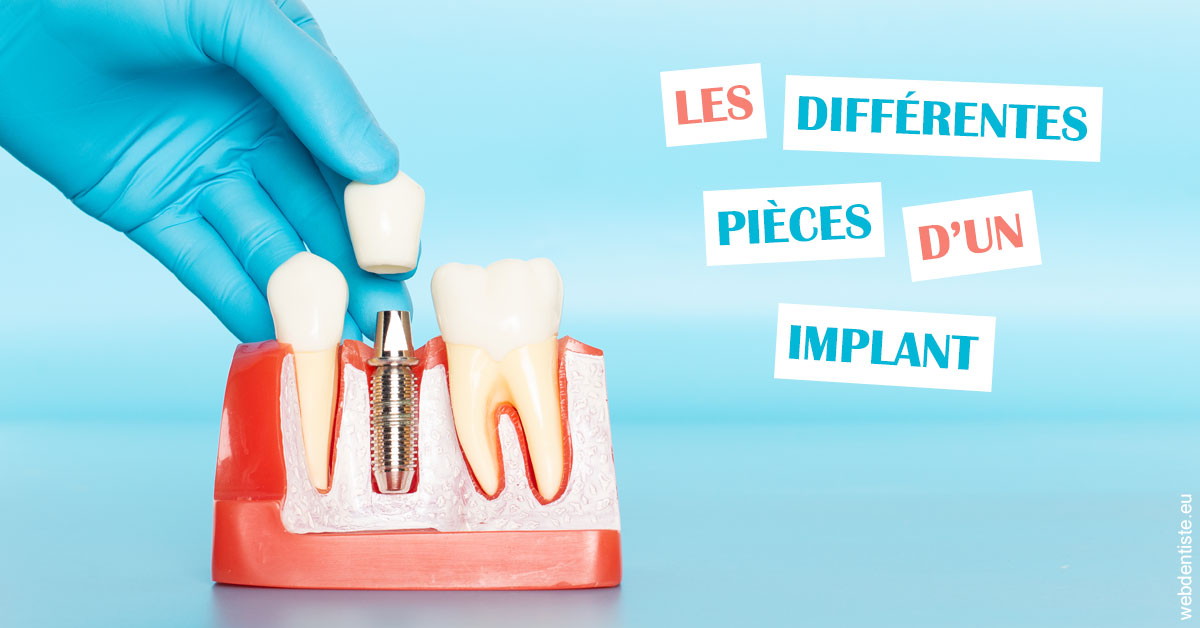 https://dentistes-trinite.com/Les différentes pièces d’un implant 2