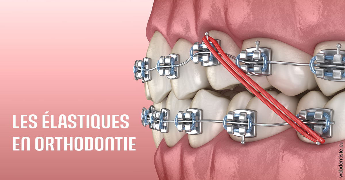 https://dentistes-trinite.com/Elastiques orthodontie 2