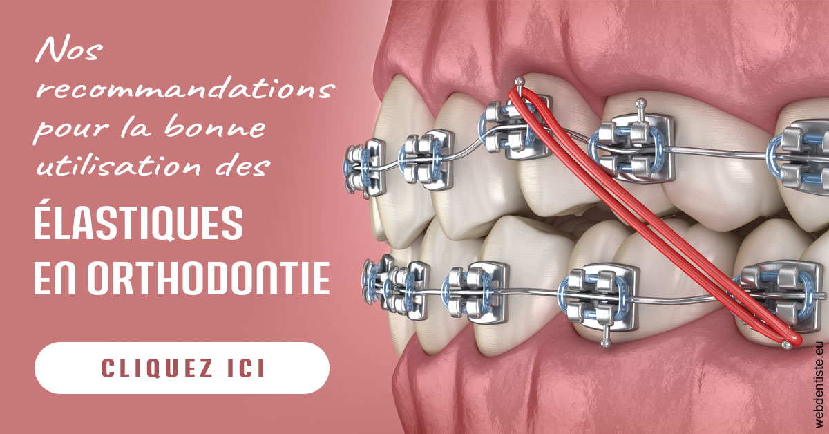 https://dentistes-trinite.com/Elastiques orthodontie 2